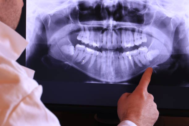 Best Emergency Care for Gum Disease in Waterloo, NE